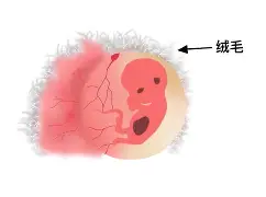新生儿青囊(新生儿囊肿需要做手术吗) 新生儿青囊(新生儿囊肿需要做手术吗)